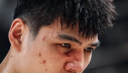 ng体育官网-伤痕明显！广州状元陈国豪面部骨裂 季后赛大概率戴面具对阵广东